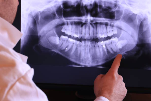 Best Emergency Denture Repair in Mount Olive, NC