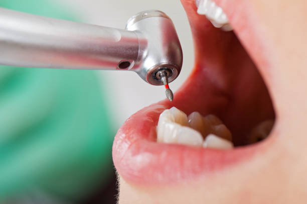 Best Emergency Care for Gum Disease in Mount Olive, NC